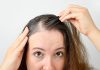 5 COMMON REASONS WOMEN EXPERIENCE HAIR LOSS